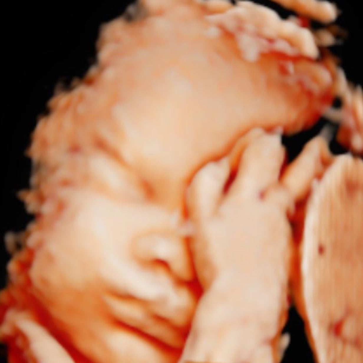Imagem de ultrassom com uma mão ao lado da face